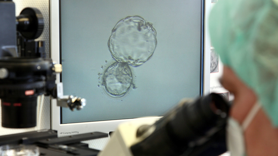 Eine Frau schaut durch ein Mikroskop und im Hintergrund sieht man auf einem Bildschirm eine befruchtete Eizelle