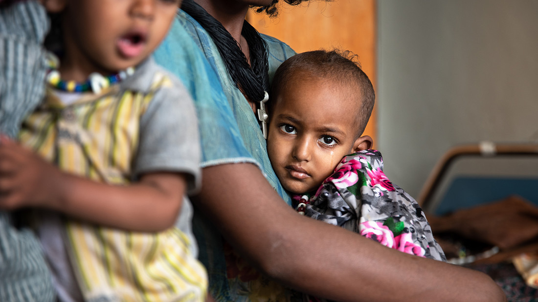 Unterernährte Kinder im Zentralkrankenhaus in Mekele in Äthiopien