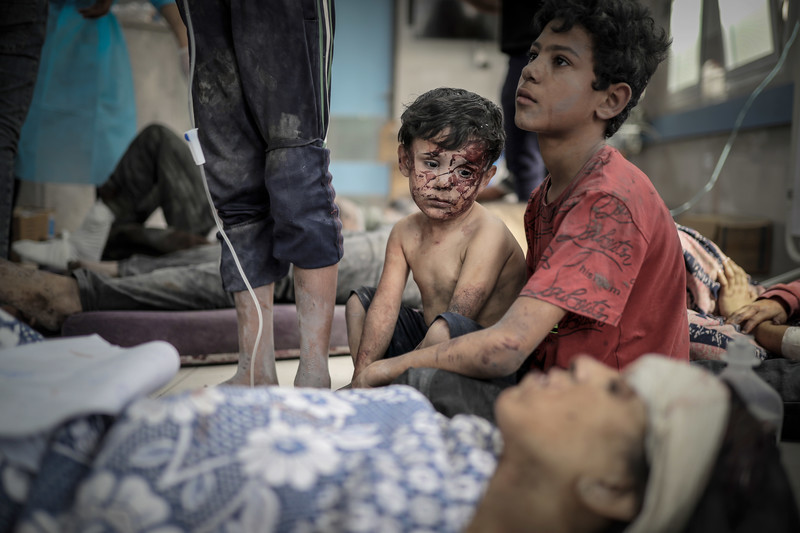 People injured after Israeli attacks, are taken to Al-Shifa Hospital, Gaza  