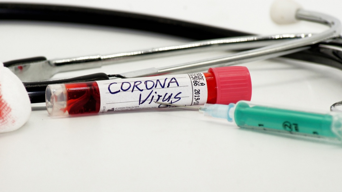 iInDeutschland sind zwei Menschen an den Folgen des Coronavirus zu Tode gestorben. 