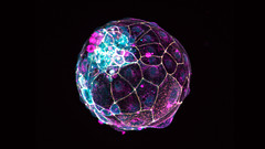 Dieses Embryo-Modell, ein sogenannter "Blastoid", sieht einem fünf bis sechs Tage alten echten Embryo extrem ähnlich