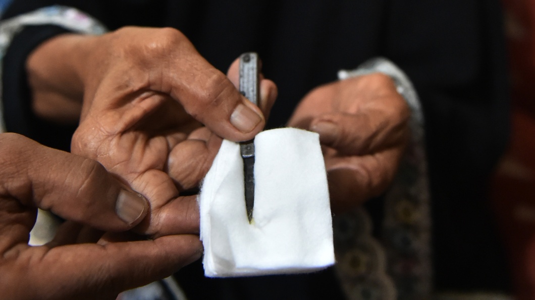 Eine Frau in Indonesien zeigt Werkzeuge, mit denen Beschneidungen vorgenommen werden.