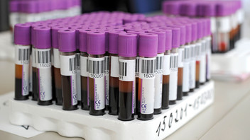 Viele Glasröhrchen gefüllt mit Blut stehen in einer Ständervorrichtung im Labor 