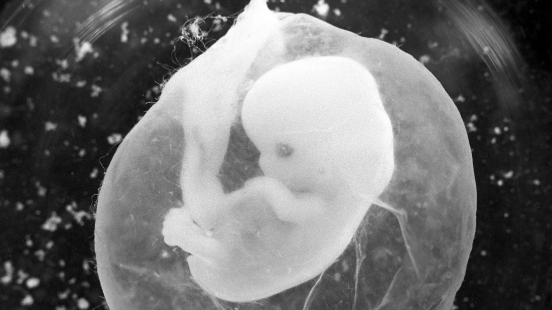Ein sieben Wochen alter Fötus in einer Fruchtblase. 