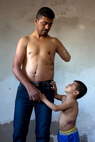 Der fünfjährige Badruddin und sein Vater Nabil Siyam, der im Gazakrieg schwer verwundet wurde.
